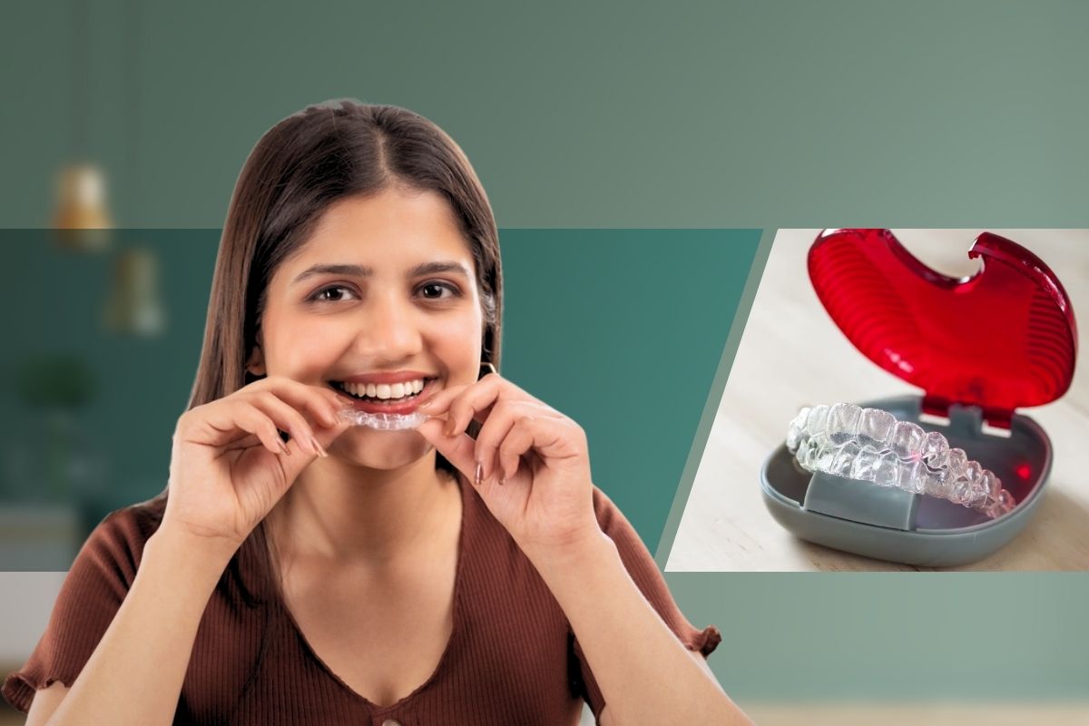 Invisalign